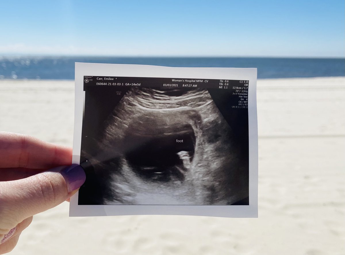 emileebemilee's tweet photo. I’m so in love with you already 💙 https://t.co/83tAfwv1yS