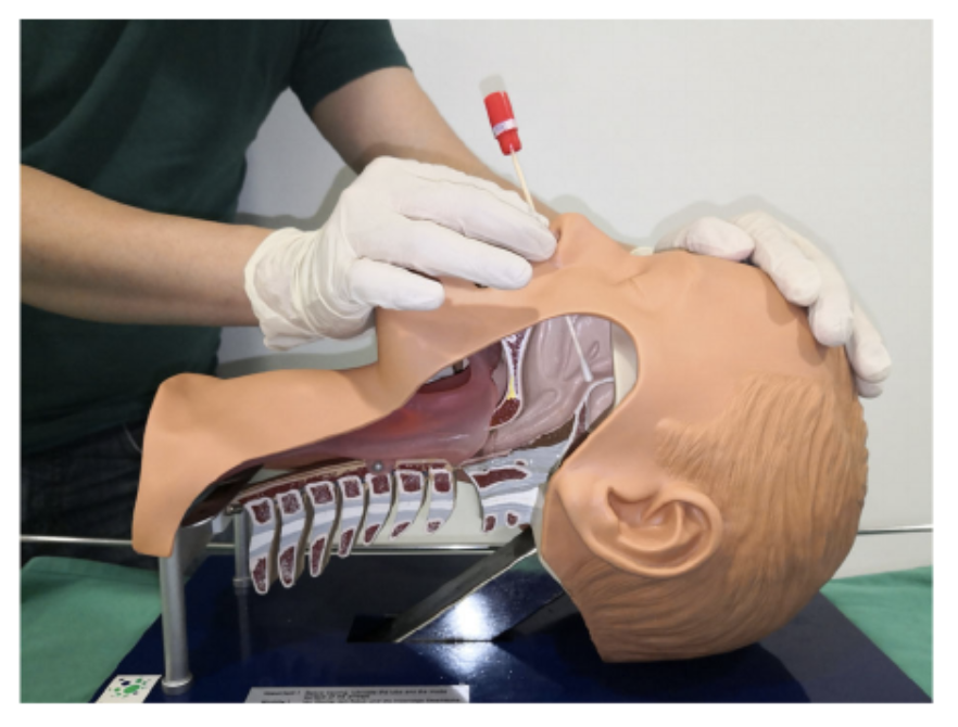 𝘈𝘯𝘢𝘦𝘴𝘵𝘩𝘦𝘴𝘪𝘢 𝘙𝘦𝘱𝘰𝘳𝘵𝘴 (@anaes_reports) on Twitter photo Wondering how to perform a transnasal sphenopalatine ganglion block for post‐dural puncture headache and associated tinnitus?
Here's an example of the technique!
<a href="/lenny_lemony/">Leonard Loh</a>
#FreeForAWeek
…-publications.onlinelibrary.wiley.com/doi/full/10.10… Wondering how to perform a transnasal sphenopalatine ganglion block for post‐dural puncture headache and associated tinnitus?
Here's an example of the technique!
<a href="/lenny_lemony/">Leonard Loh</a>
#FreeForAWeek
…-publications.onlinelibrary.wiley.com/doi/full/10.10…