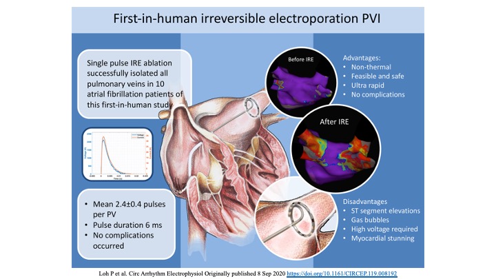 drraviele's tweet photo. The first clinical use of single pulse irreversible electroporation ablation as a promising new technique for rapid and safe PV isolation in pts with AF has been reported in #CIRCEP @DrRoderickTung @LuigiDiBiaseMD @DrJasonAndrade @EJSMD @DhirajGuptaBHRS https://t.co/5uNqqtdjAE https://t.co/uvmjNKISfM