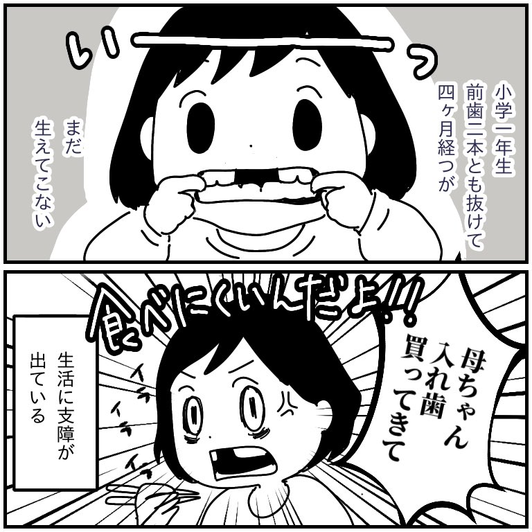 歯がないと不便 