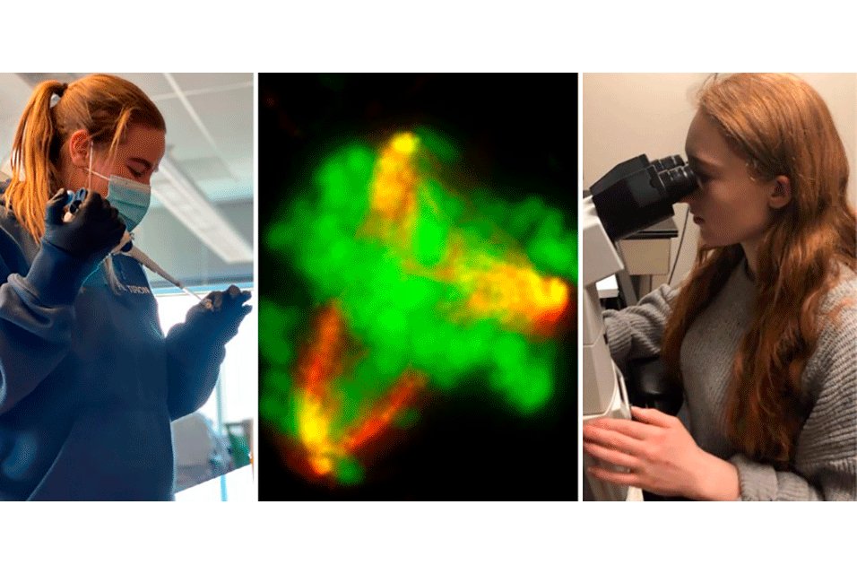 artdaily's tweet image. ArtDaily recommends:
UVM alumnae contribute to groundbreaking cancer discovery #UniversityofVermont #cancer #discovery #science #newspaper @uvmvermont University of Vermont 

Read more about this here: ow.ly/vyIi50DPfim