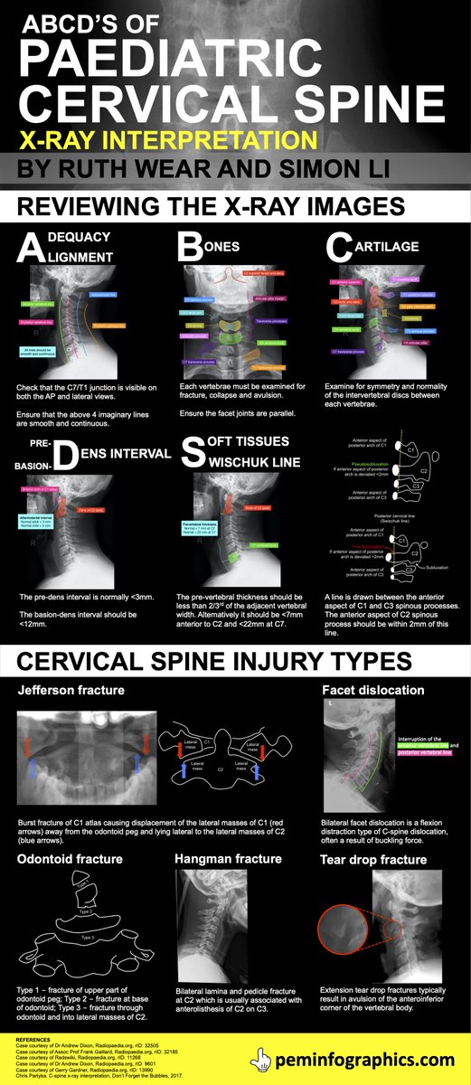 In the first of a series, Dr Ruth Wear and <a href="/_lisim1/">Simon Li</a> take us through #paediatric cervical-spine X-ray interpretation for today's #fabulousinfographicfriday

Best viewed on a big screen!