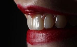 ProfDhomPartner's tweet image. Ein Zahnimplantat ist ein invasiver Eingriff, der immer mit bestimmten Risiken verbunden ist. Im Vorfeld wird deshalb eine umfangreiche Untersuchung vorgenommen, bei der bsp. festgestellt wird, ob der Patient überhaupt für ein Implantat infrage kommt.
buff.ly/30dX2xy