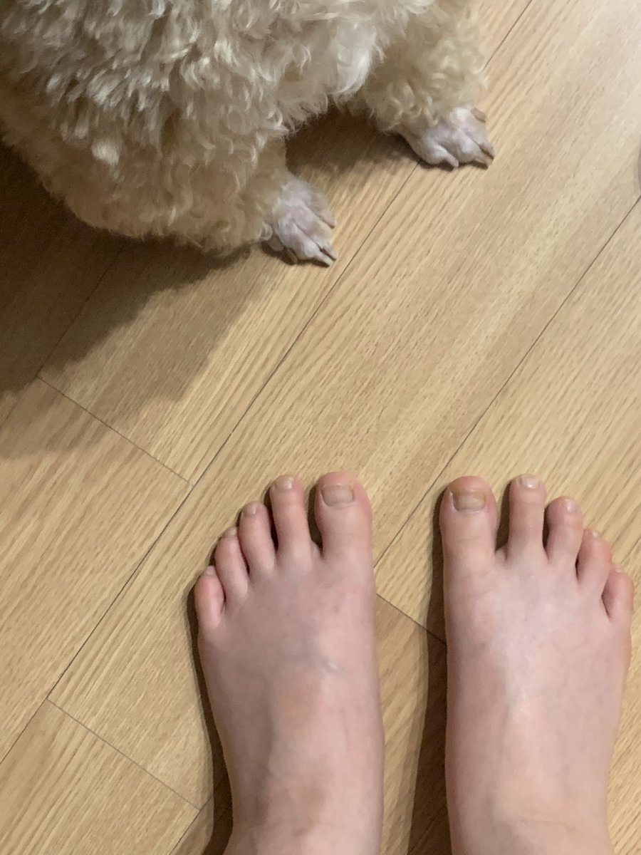 kkooroolife's tweet photo. 발이 퉁퉁부은 39주 임산부와 닭발 https://t.co/Zw50gqWoCX