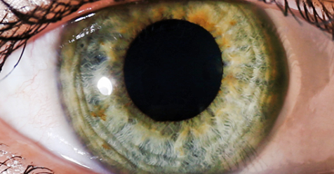 touchOPHTHALMIC's tweet photo. Learn about pediatric nasolacrimal duct obstruction; Shani Golan, Gary J Lelli Jr;US Ophthalmic Review. 2018;11(2):87–90; Click here to find out more: https://t.co/8jpZ0g61ri
#NasolacrimalDuctObstruction #epiphora #conjunctivitis,  #dacryocystits https://t.co/YO6dKxFnW0