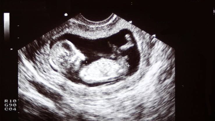 I’m happy to announce that I am expecting my second child. Dylan is an amazing dad and we’re excited to be growing our family.