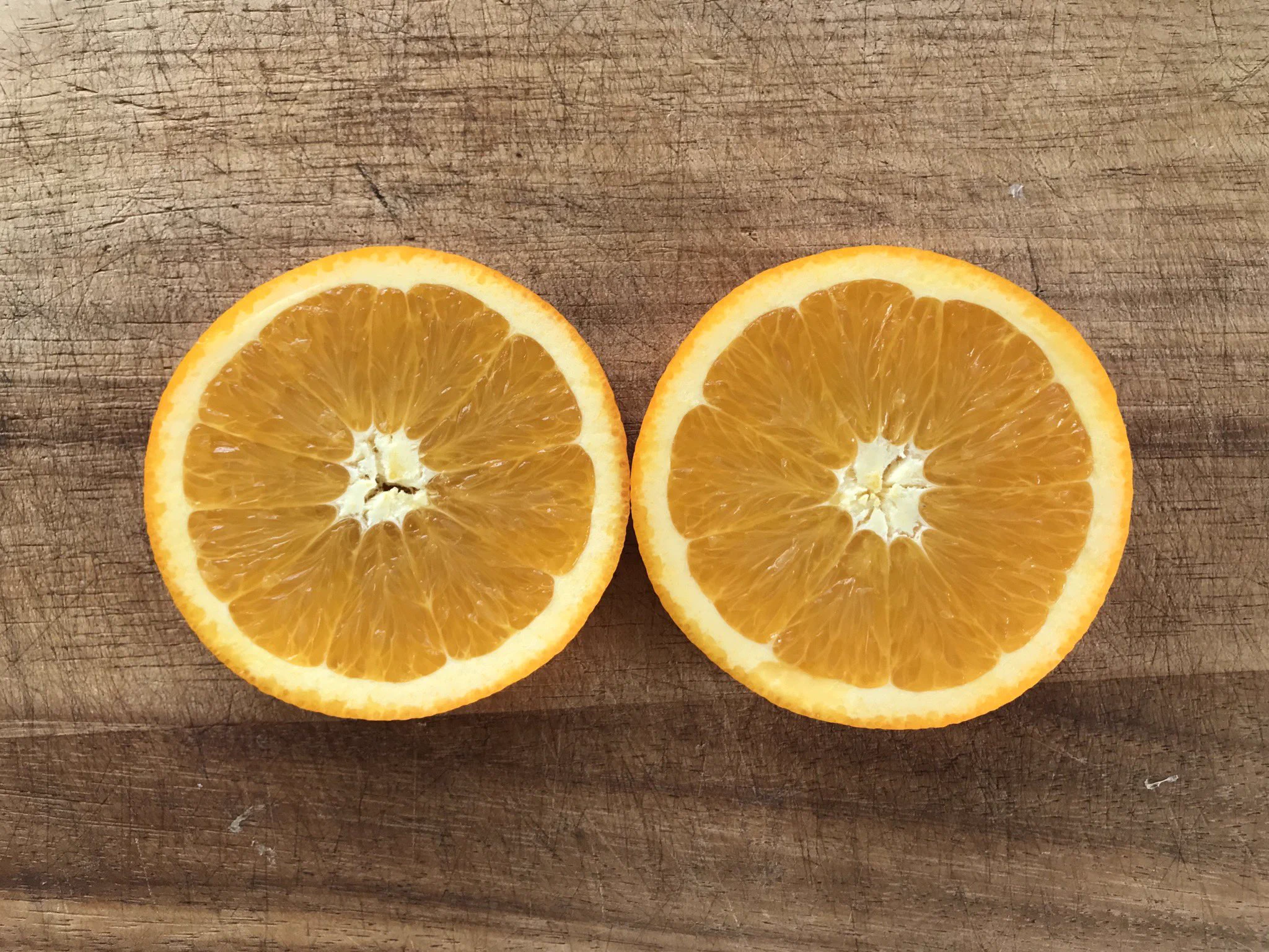 ストレス抱えていませんか？瞼のぴくぴくはストレスサインですよ！