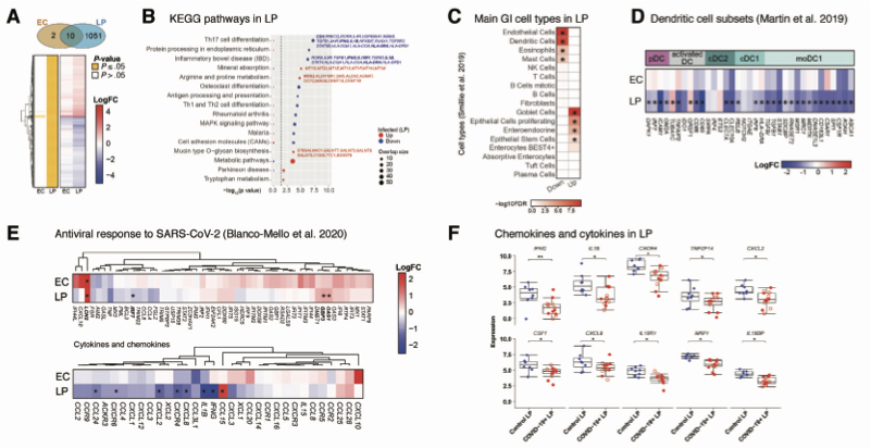 Intestinal host response to SARS-CoV-2 infection | #COVID19 #Gut | Saurabh Mehandru @a_livanos @divyajha_phd @gonzalezreiche @MinamiTokuyama @TeresaAydillo @tommasoparigi @petra_fra @saurabhmehandru @MountSinaiGI | Gastroenterology @AGA_Gastro bit.ly/3e8QqZm