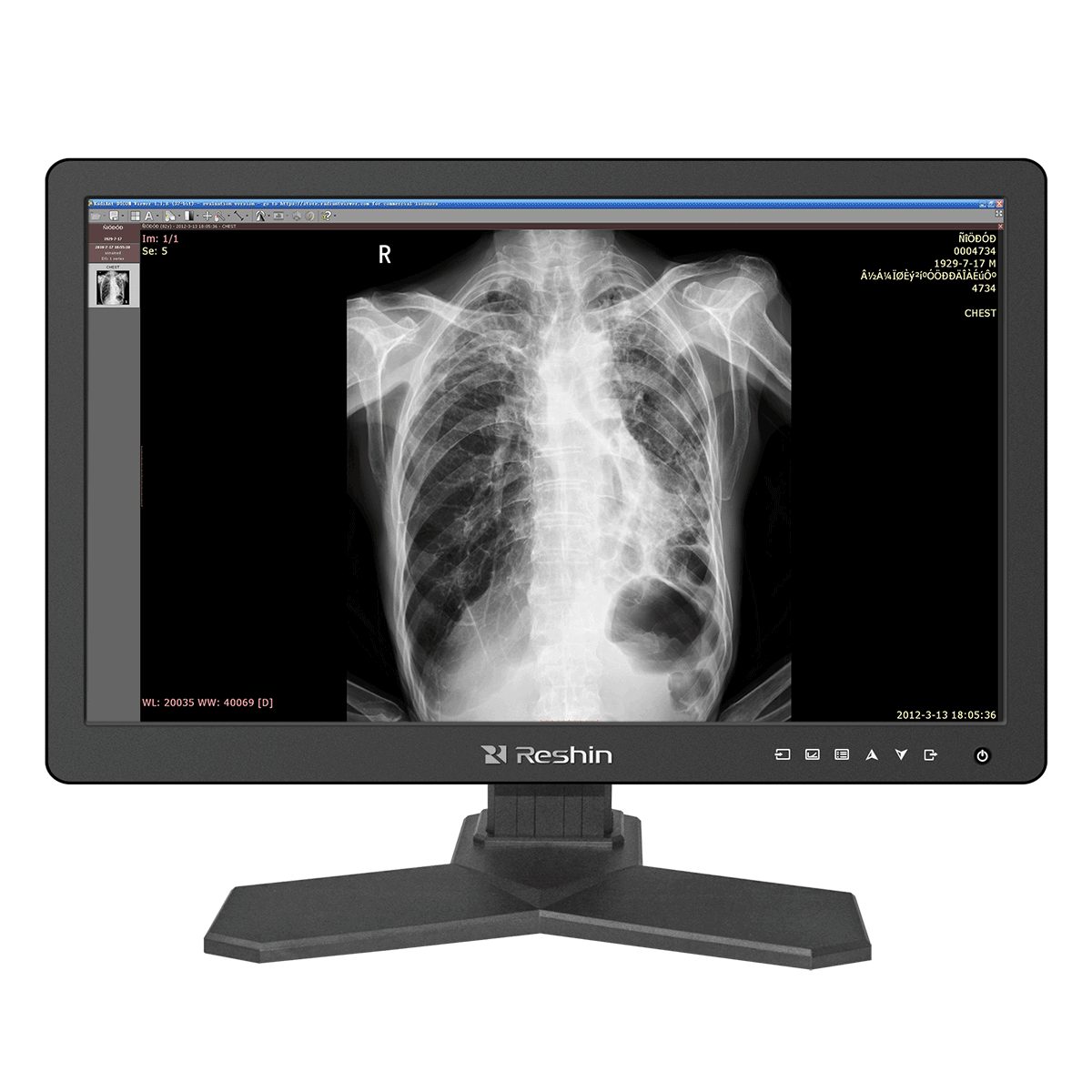 jlddisplay's tweet image. JLD has been well-known for its exquisite Anti-radiation energy-saving diagnostic display for wholesale. medicalmonitor.net/anti-radiation… #surgicaldisplays
