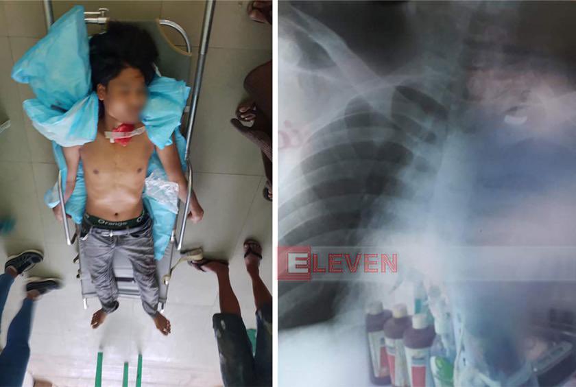 A 27-year-old man is shot dead around 12pm today in Mandalay. According to one eyewitness, “the man was not a protestor. He was dispersing the crowds in order to help others avoid the gunshots. After the crowds got dispersed, he was shot in the neck.”  #WhatsHapppeningInMyanmar
