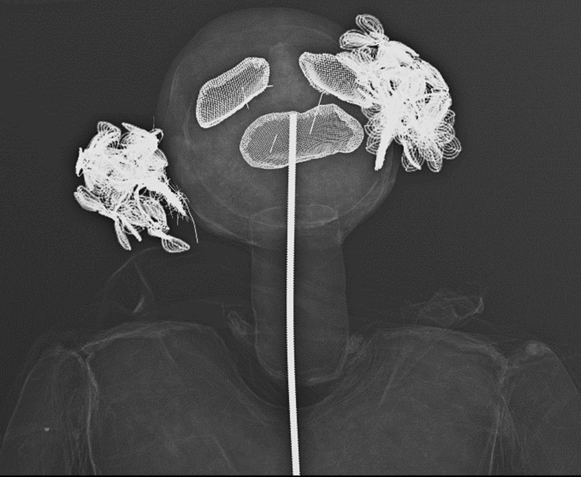 YConservators's tweet photo. “Put out the light”, turn X-ray on!
Let’s take a closer look inside this textile figure called #Desdemona by #EvaAeppli using #xray. Areas which stand out brightly in X-ray mark components with higher density and atomic number, e.g. integrated metals.
#conservation #arttechnology https://t.co/YnkDwOAYr5