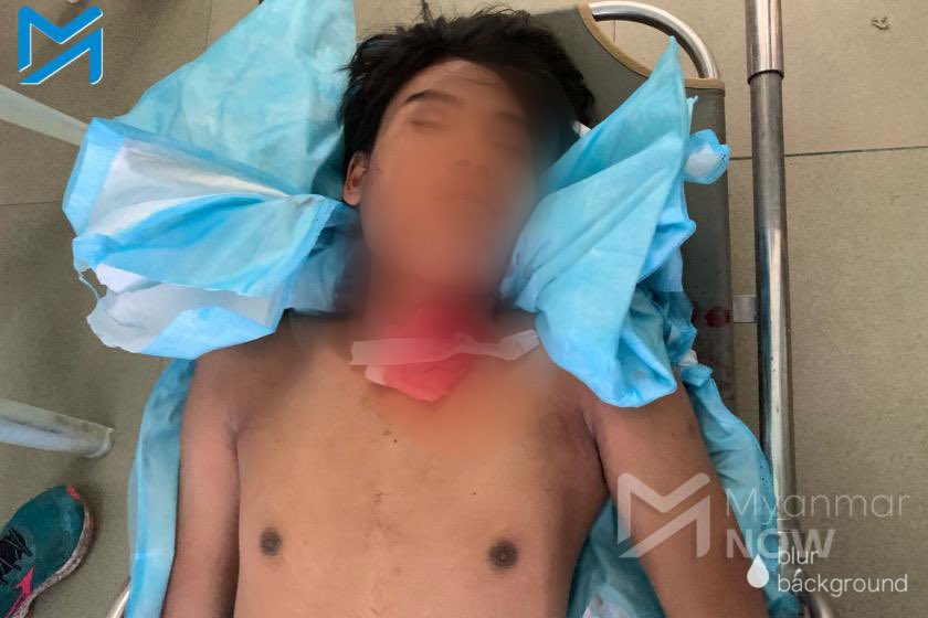 🛑 State sponsored Terrorism in Myanmar 🛑 tw // blood, violence.

In Mandalay, 20-year-old Zaw Myo was shot and killed in the neck today. 

#Mar5Coup
#WhatsHappeningInMyanmar
#OpCCP
<a href="/RapporteurUn/">UN Special Rapporteur Tom Andrews</a> 
<a href="/UNHumanRights/">UN Human Rights</a> 
<a href="/UN/">United Nations</a> <a href="/BBCWorld/">BBC News (World)</a>
<a href="/TostevinM/">Matthew Tostevin</a> <a href="/UNICEF/">UNICEF</a> <a href="/YourAnonCentral/">Anonymous</a>