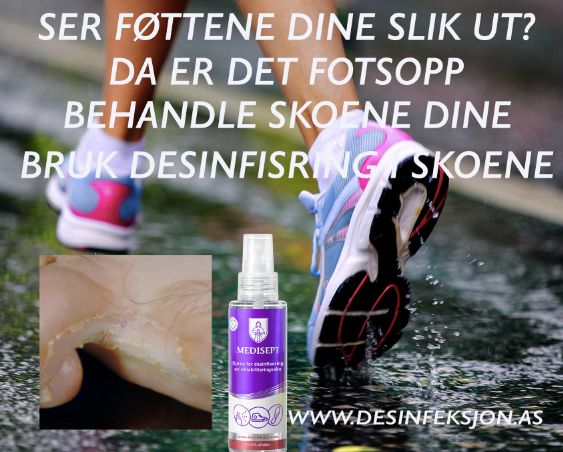 Des_infeksjon's tweet photo. Ser foten din slik ut? da kan det være fotsopp, behandle skoene så blir du kvitt soppen.
#fotsopp #tåfis #neglesopp #desinfeksjon #desinfisere #luktisko #jogging #spa #fitnes #trening https://t.co/ksOsoLn7kQ
