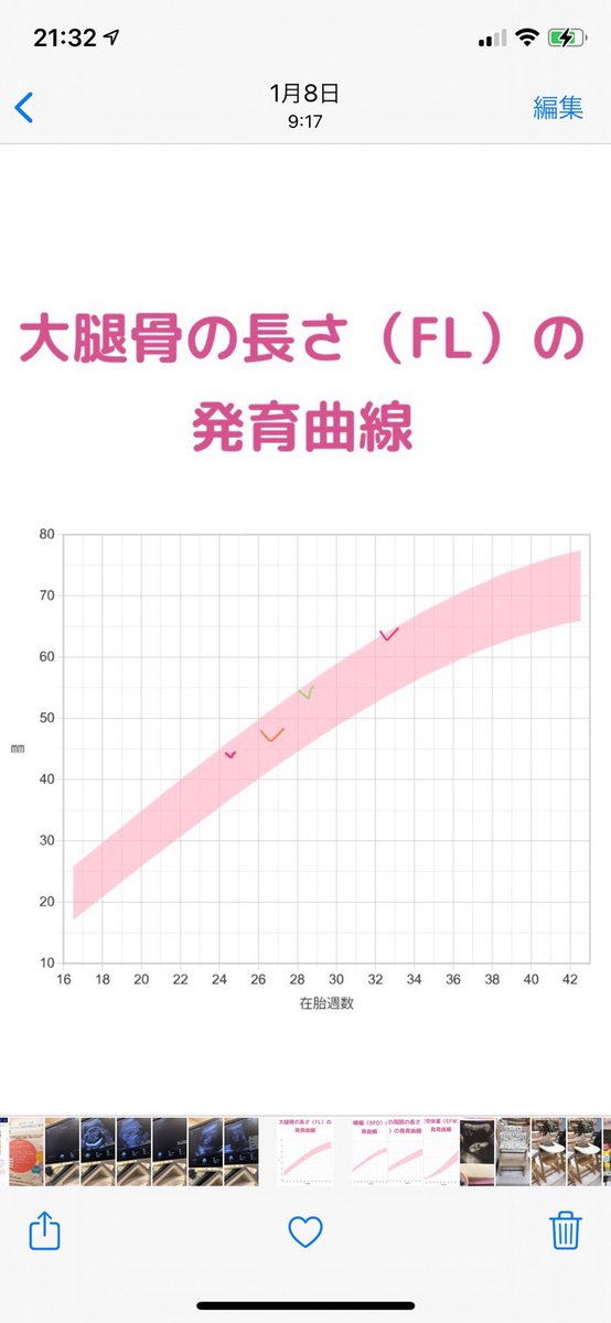 逆子治った