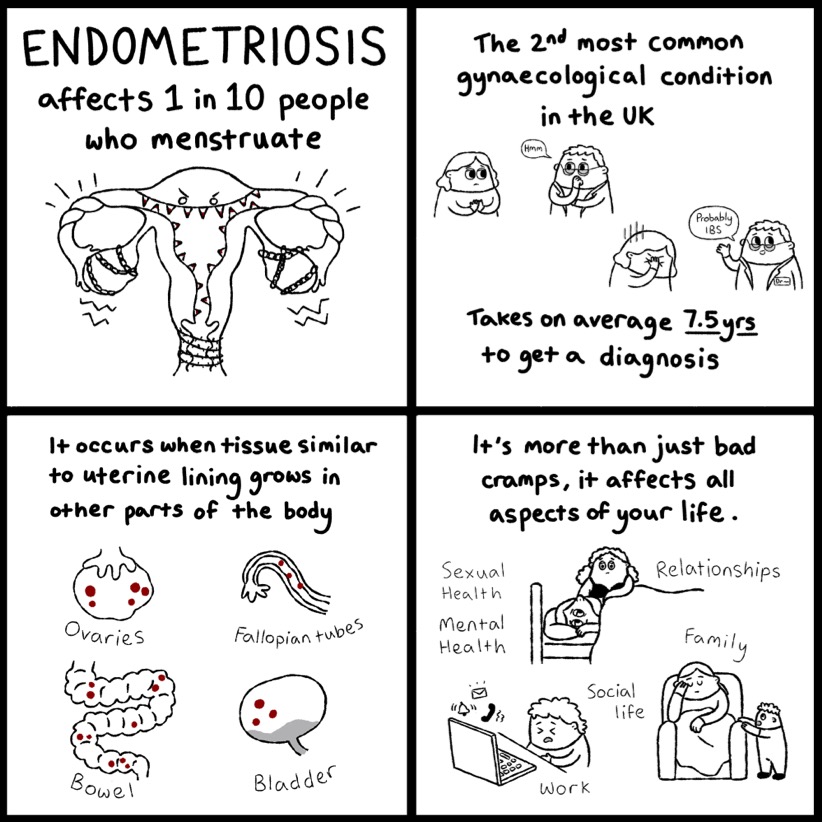 Comicsyouth's tweet photo. March is #EndometriosisAwarenessMonth- let's start with the facts, a thread: 
 
When tissue similar to the lining of the womb is found outside of the uterus, it causes an inflammatory reaction in the body which can lead to lesions and scar tissue.

#GraphicMedicine #Endometriosis https://t.co/FVC8zbUEBl