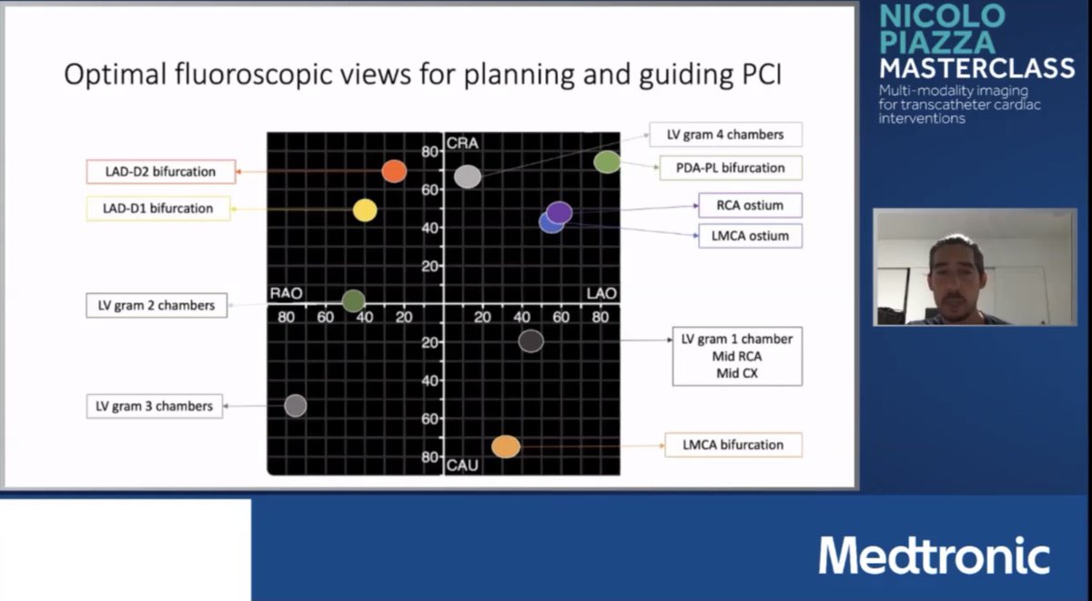 2/4 Also just discovered this excellent (and highly relevant) video: “Mastering fluoroscopic coronary anatomy for PCI” by @nicolo_piazza (courtesy of: @DebbieNercolini): vimeo.com/443381853👍...