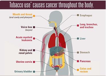 CDC_Cancer's tweet photo. Tobacco use increases your risk of many types of cancer, including colorectal cancer. What you need to know this #ColorectalCancerAwarenessMonth: https://t.co/rXDjvBPNaQ https://t.co/JiShIDfGAQ