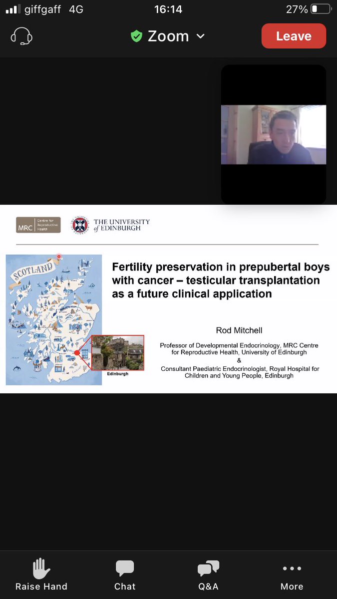 MinaNMincheva's tweet photo. @RodTMitchell speaking now @oncofertility on #fertilitypreservation in prepubertal cancer boys https://t.co/l0hmz3Tyuu