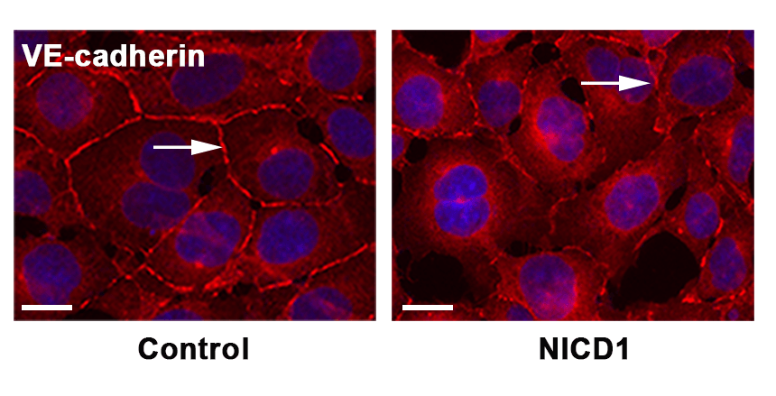 CircRes's tweet photo. Li and colleagues found that endothelial #Notch1 activation increased permeability of human #renal glomerular #EndothelialCells through decreased VE-cadherin expression and led to #albuminuria a sign of kidney disease. Learn more at https://t.co/ejrfd78dKY 

@tradewindbio https://t.co/EebSaUMKN4