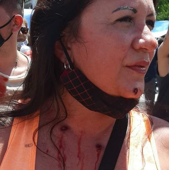jproSanFernando's tweet photo. No es noticia que en Formosa hace años no se respetan los DD.HH. de las personas, lo que aturde e indigna es el silencio del gobierno de @alferdez ante la dictadura de Gildo Insfran. Nuestro más absoluto repudio a la represión hacia el pueblo Formoseño. #FormosaLibre https://t.co/7LCohXS7Ig