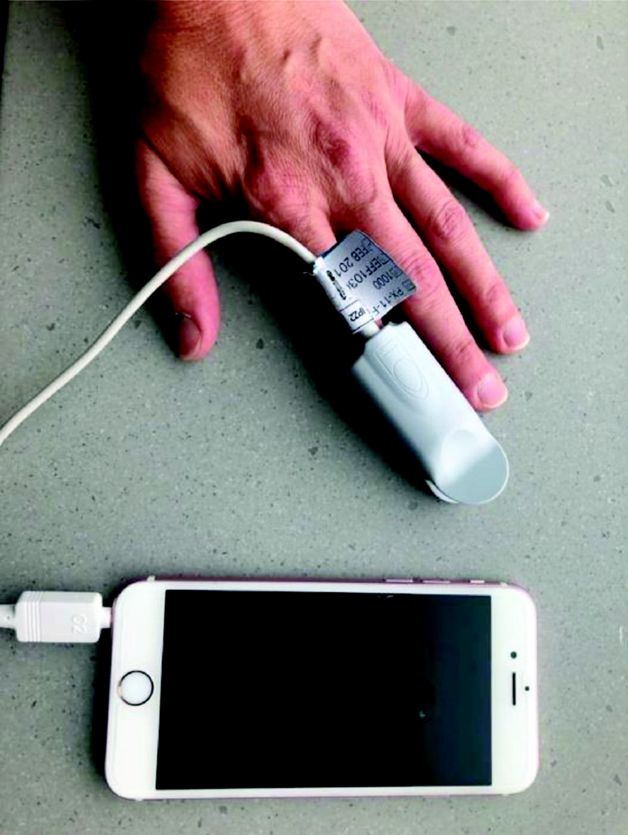respcare's tweet image. Modi et al evaluated pulse oximetry apps on different smartphones. 

They compared their accuracy to those used in hospital in subjects who presented for pulmonary function testing.

bit.ly/3r8rq8d
