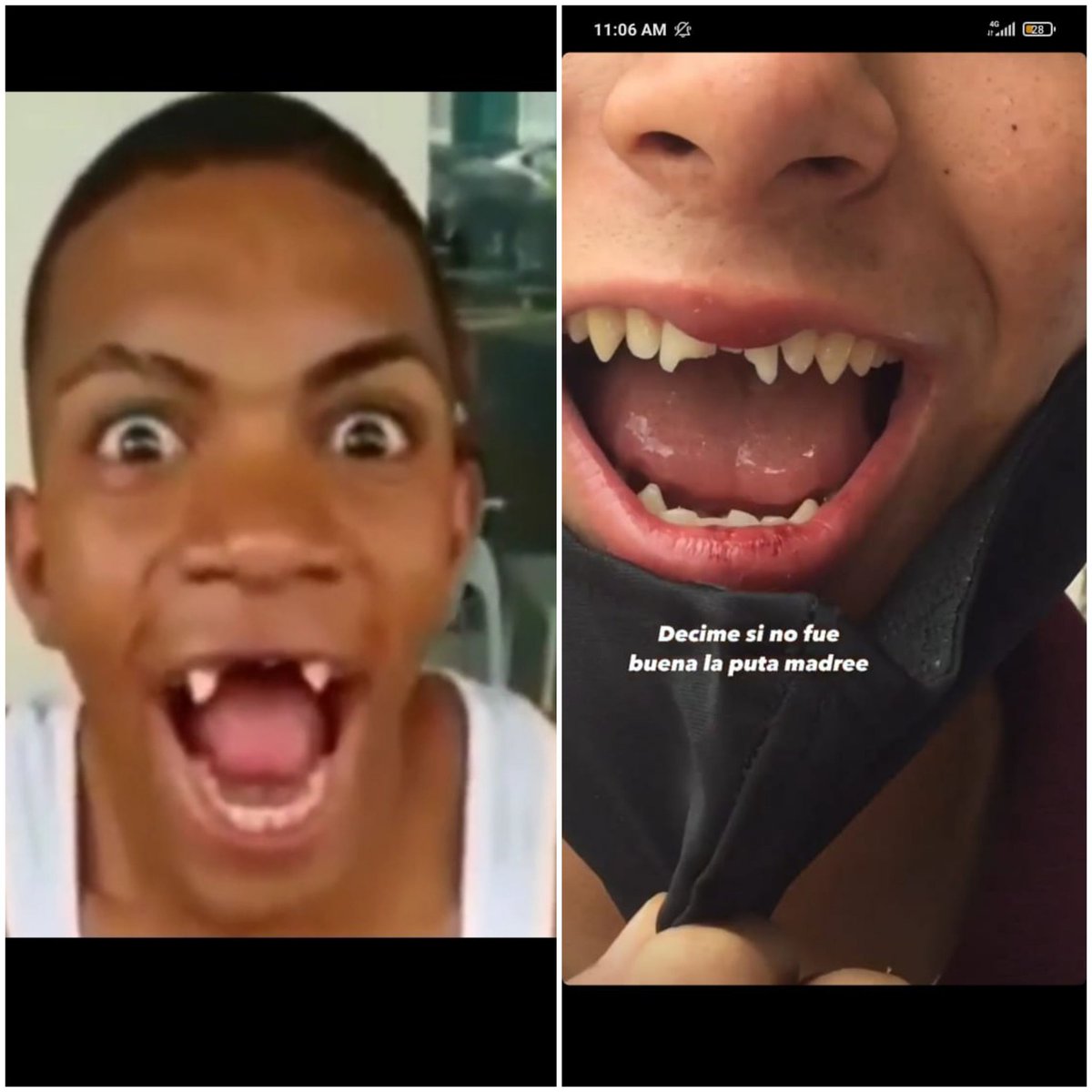Se buscan los dientes de mi amigo, se vieron por ultima vez en las vias del ferrocarril