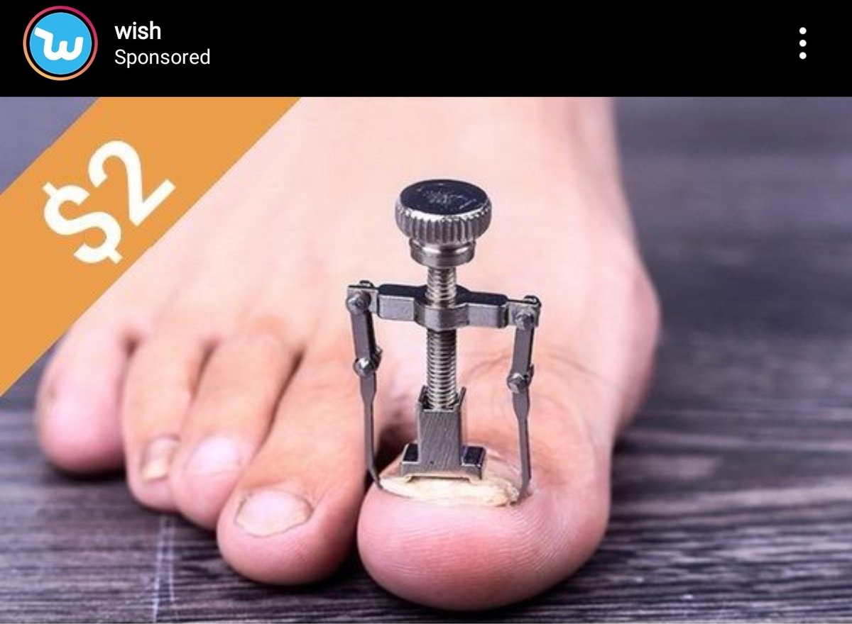 chrisnchrisn's tweet photo. will I need one for each toe cuz that's a bit out of my budget https://t.co/zK6owTSFdb