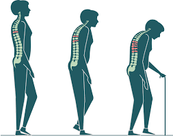 doctorneyro's tweet photo. Seguro que no lo oíste así.
¿Cuidas a tu #madre?
¿Tiene #osteoporosis?
¿#Sabíasque mata #4veces más #mujeres que el #cáncerdemama?
Ah, que no importa porque son #viejas?
Igual dicen (en #privado) algunas de nuestrs (respetadas) #autoridadesanitarias.
https://t.co/1ZrIQhYK6b https://t.co/Wc5v5u8H0L