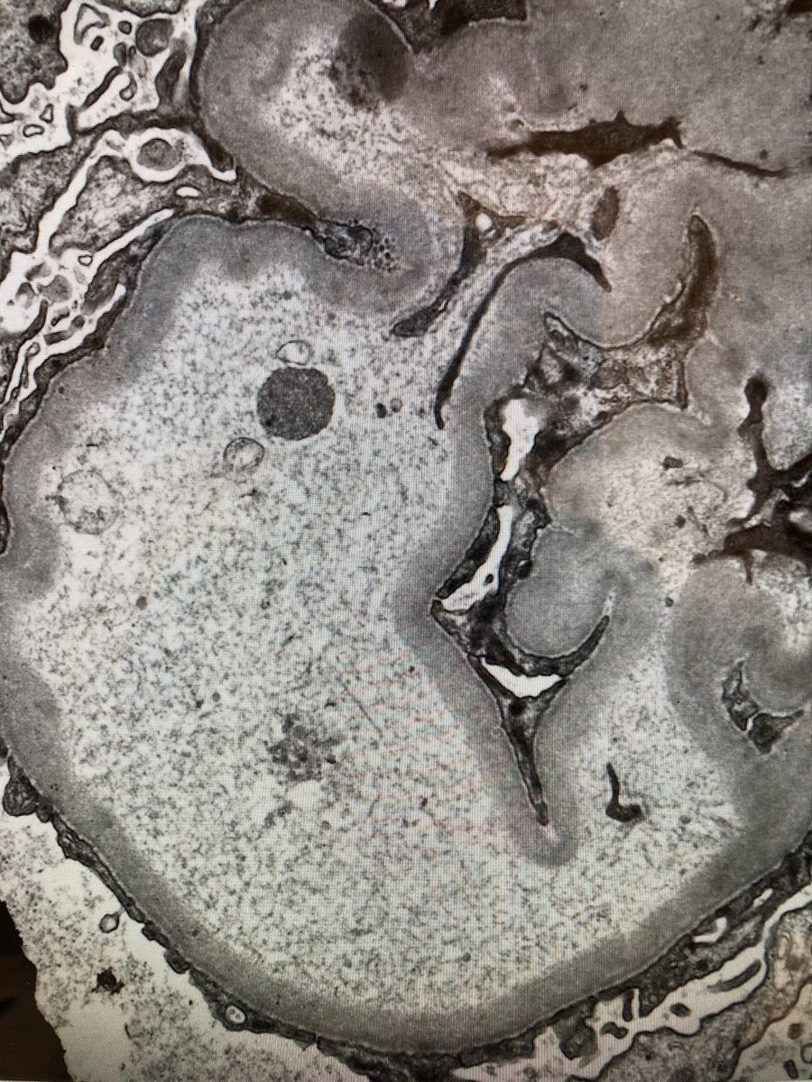 Question of the day: What is missing in this picture? #bwhkidney #bwhpath