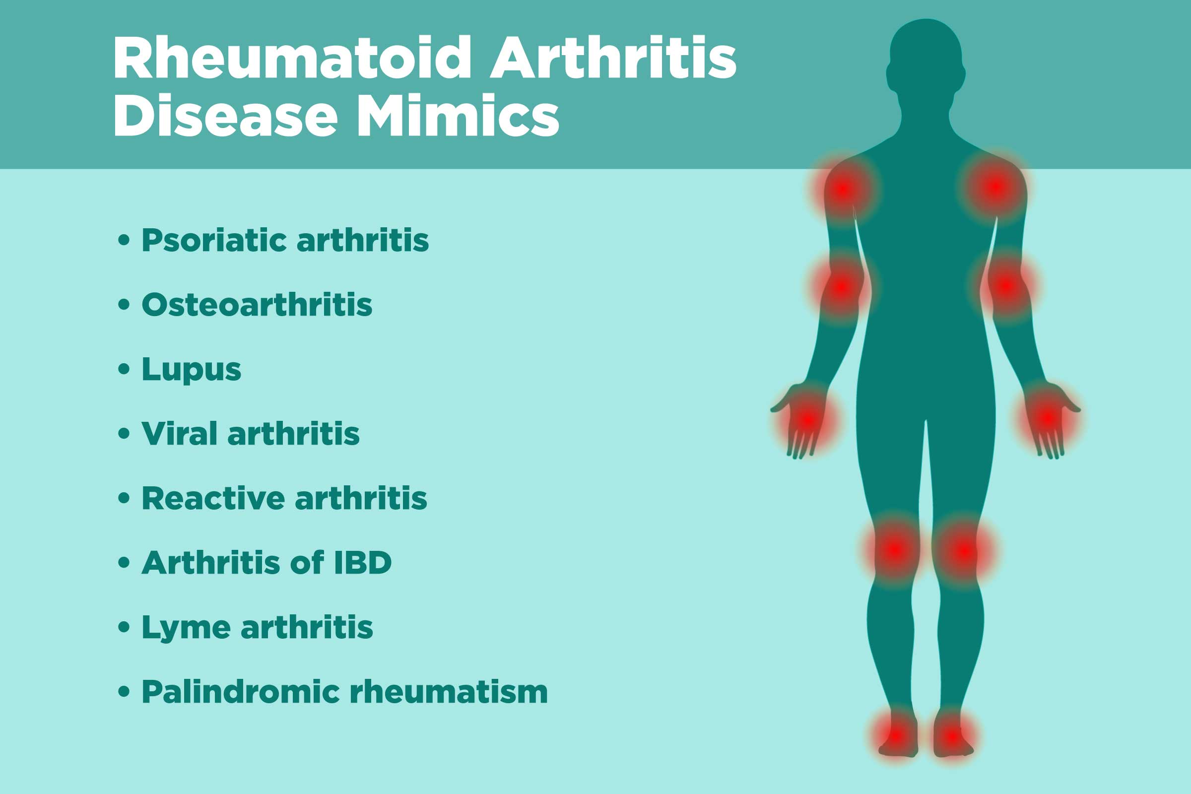 Síntomas artritis reumatoide y fibromialgia