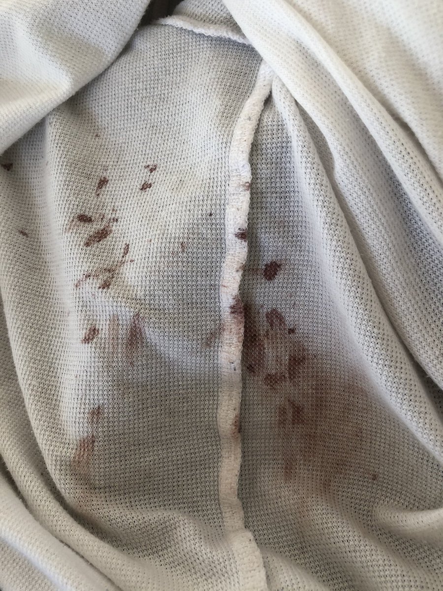 いつつば 朝起きたら 下シャツ血だらけだったアトピーあるある