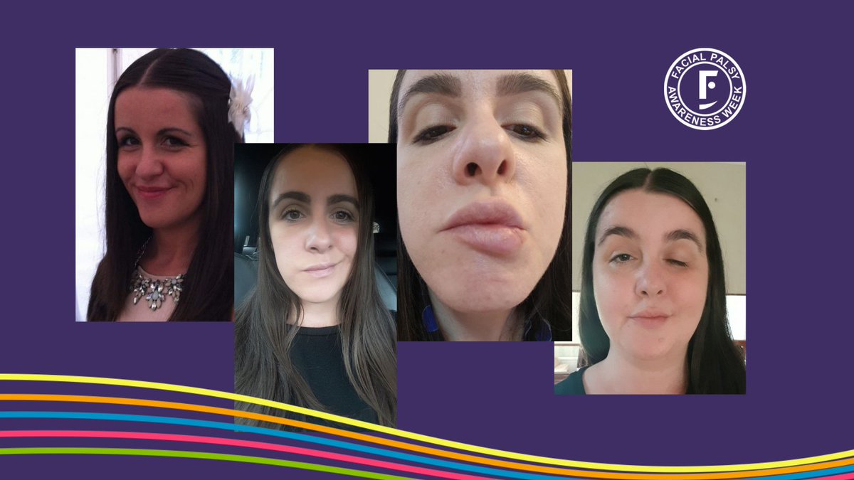 Sarah's story highlights why we need specialist Facial Palsy Centres in the UK. Initially misdiagnosed with Bell's palsy, Sarah was eventually found to have both #MelkerssonRosenthalSyndrome and #MyastheniaGravis. 
buff.ly/3kaio86
#FacialPalsy #BellsPalsy #FaceMyDay