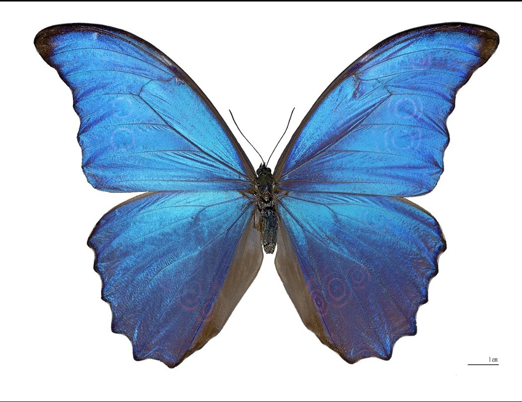 MarinaCgil's tweet photo. Hoy es el día mundial del linfedema tanto primario como secundario. Por una investigación y mayor visualización/ información de esta enfermedad que afecta a muchos pacientes.💪🦋💙 https://t.co/WlDr6uPetH