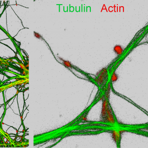 #ResultatScientifique 🔎📕 l Nano-imagerie corrélative des métaux et des protéines à l’échelle de la synapse

🤝 @IN2P3_CNRS  #MITI <a href="/esrfsynchrotron/">European Synchrotron</a>  <a href="/CNRSAquitaine/">CNRS Aquitaine</a> <a href="/univbordeaux/">Université de Bordeaux</a>
➡️ buff.ly/37QJ3BP