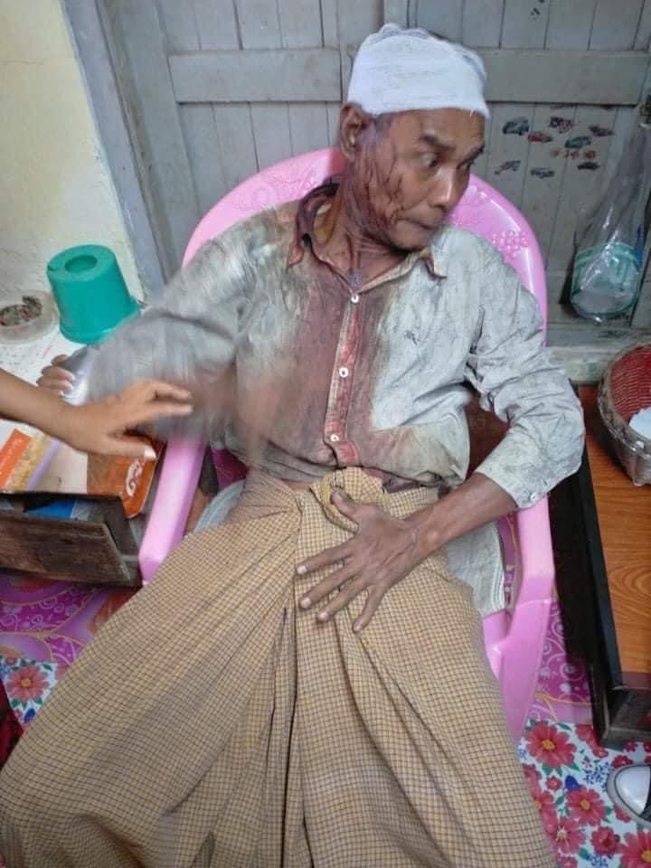 hannah_chaw's tweet photo. Happening in Thaketa; An elderly person was ruthlessly tortured by Junta’s armed terrorists. Grandpa was cruelly beaten and shot with rubber bullet too. Ruling Junta is committing violations against civilians.
IMPLEMENT R2P
#Mar6Coup
#WhatsHappeningInMyanmar @USEmbassyBurma https://t.co/4meBpNVUeM