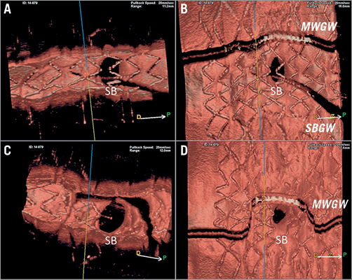 EuroIntervention tweet media