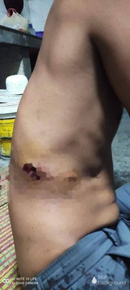 rikilinn135's tweet photo. tw // blood // wound 
A man got shot by military junta terrorists just now in ChanMyaTharSi township, Mandalay. 5 people were also reportedly arrested.
FREEDOM OF SPEECH
#WhatsHappeningInMyanmar
#Mar21Coup https://t.co/dw36q12yHl