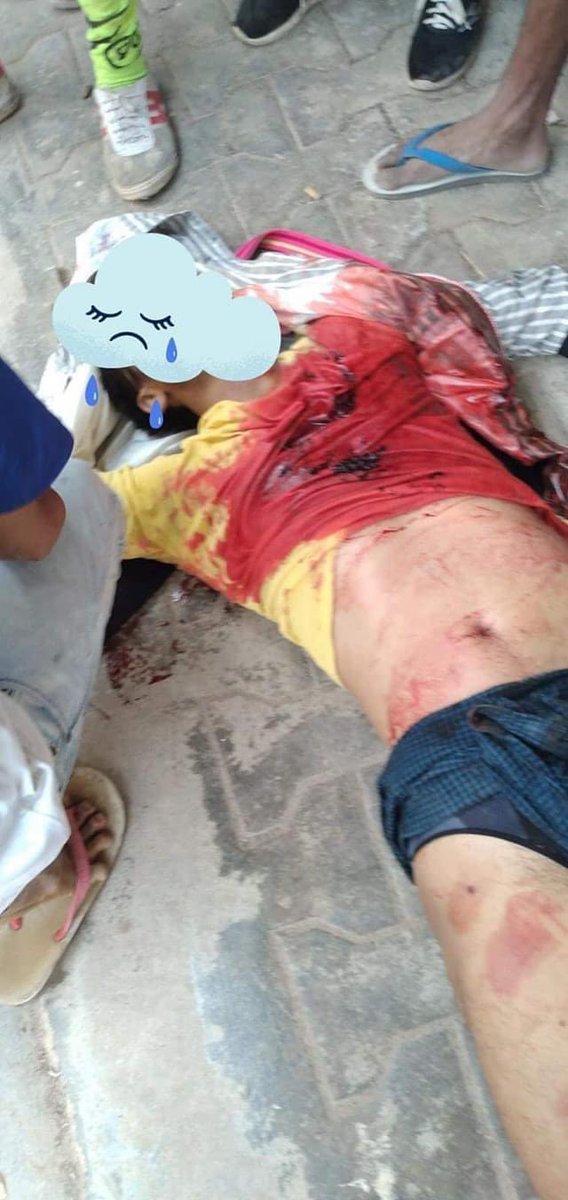 JoPixy1988's tweet photo. GRAPHIC CONTENT!! 

Happening in #AungPan, Shan state. Terrorists group crackdown &amp; fire gunshots with Live Bullets violently this morning. 6 citizens got shot and many citizens are injured. 
R2P NOW 
#WhatsHappeningInMyanmar 
#Mar19Coup https://t.co/SpgkvcXxvA