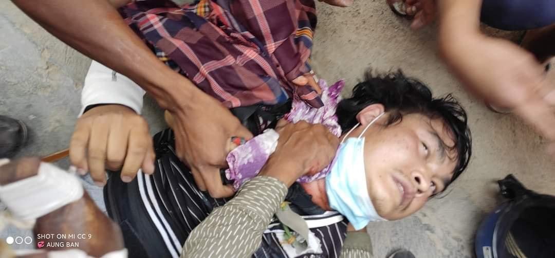 JoPixy1988's tweet photo. GRAPHIC CONTENT!! 

Happening in #AungPan, Shan state. Terrorists group crackdown &amp; fire gunshots with Live Bullets violently this morning. 6 citizens got shot and many citizens are injured. 
R2P NOW 
#WhatsHappeningInMyanmar 
#Mar19Coup https://t.co/SpgkvcXxvA