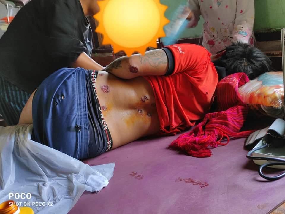 JoPixy1988's tweet photo. GRAPHIC CONTENT!! 

Happening in #AungPan, Shan state. Terrorists group crackdown &amp; fire gunshots with Live Bullets violently this morning. 6 citizens got shot and many citizens are injured. 
R2P NOW 
#WhatsHappeningInMyanmar 
#Mar19Coup https://t.co/SpgkvcXxvA