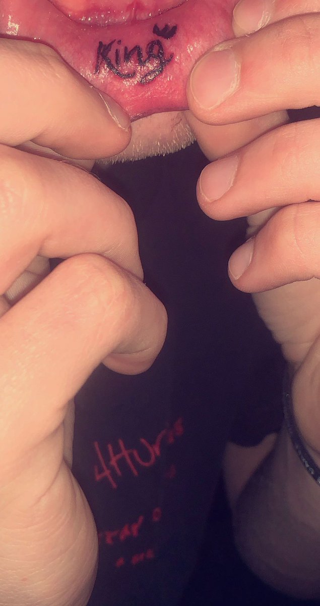 👑👑