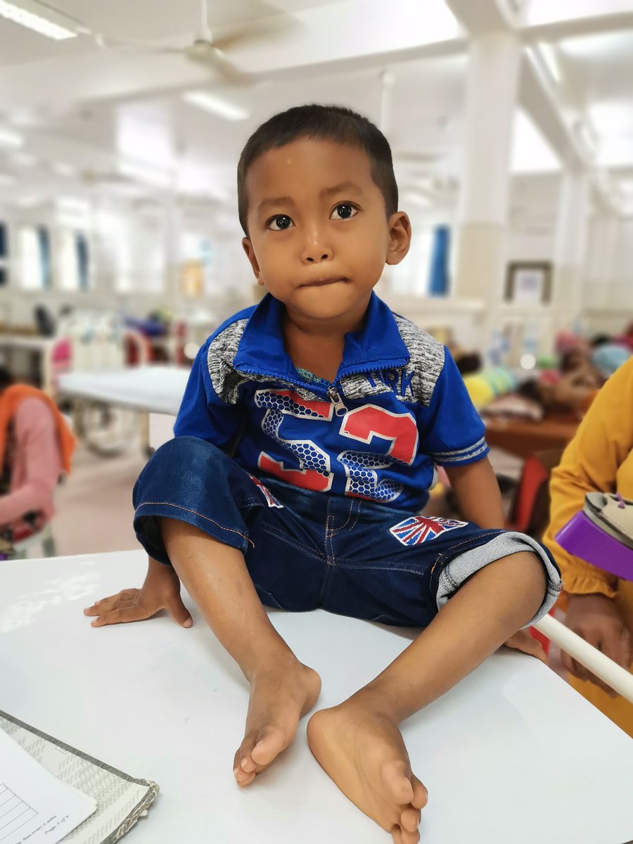 miraclefeet's tweet photo. “We could see after casting that week by week that his foot was becoming normal,” said his mother. Now his treatment is complete and his whole family is nothing but smiles.😊Congratulations, Bopha! 🎊#LeaveNoOneBehind #ClubfootJourney #MobilityMatters #ClubfootSolutions https://t.co/z6et2attKv