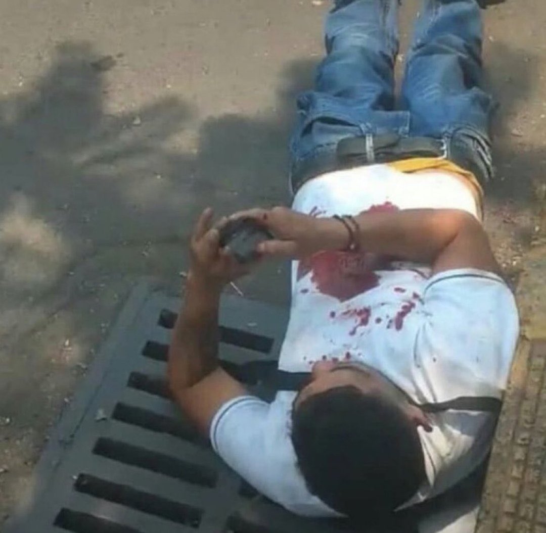 ErmanTOPRAK20's tweet photo. Tırnağın mı kırıldı ah kıyamam yaa https://t.co/TSRlHYfVOK