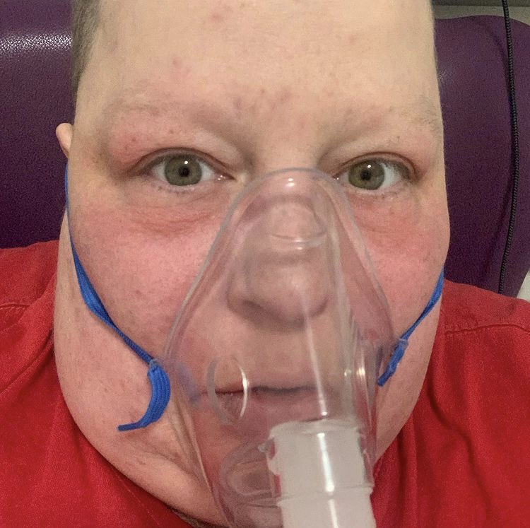 Until ALL patients with #secondarybreastcancer are living like HIV patients 20+ yrs we CANNOT call SBC “chronic” 

Understand that this is giving the WRONG impression to the public &amp; everyone thinks we’re ok - we’re not ok we are DYING

<a href="/drbexl/">Dr Bex Lewis #IAmThe31 #BusyLivingWithMets 🇪🇺💙</a> lived 2 yrs #SBCisnotchronic