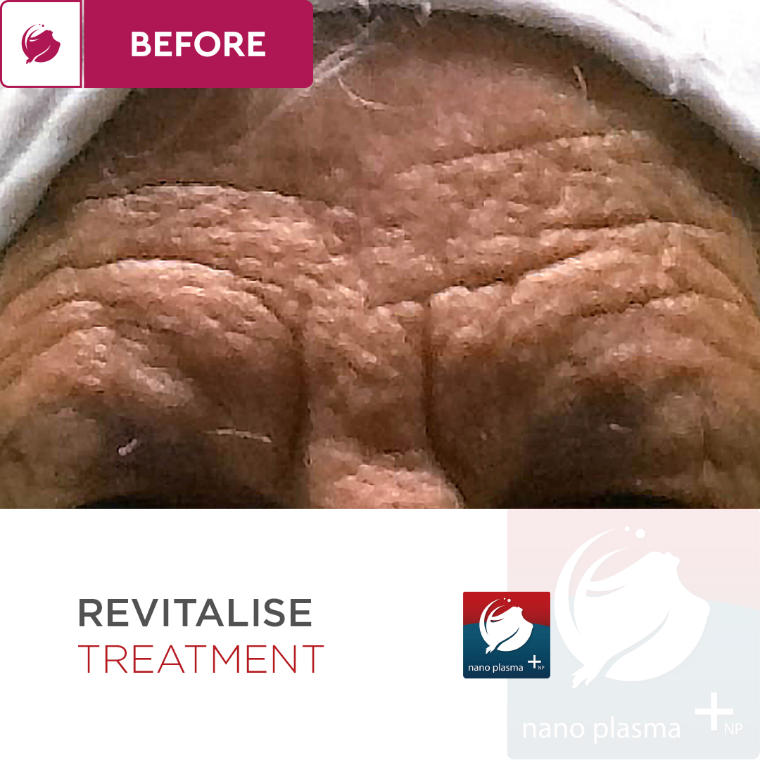 FusionGtUk's tweet photo. Amazing Results with Biodermogenesi Revitalize! 

For more information, contact us :
📧 info@fusiongt.co.uk
📞 0207 481 1656
💻 https://t.co/bCqWljY12H

#ukaesthetics #ukaestheticclinic #aestheticloctors
#doctoraestheticcentre #aestheticlondon #aestheticdoctorlondon https://t.co/LXtclLtGeq