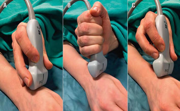 The new European Bifurcation Club consensus; long stenting using contemporary DES; five-year outcomes of CTO stenting; online three-dimensional OFDI-guided bifurcation PCIs; anaesthesia vs deep sedation in TMVR and more: the new issue is out! 
🆕bit.ly/3vGgfGG