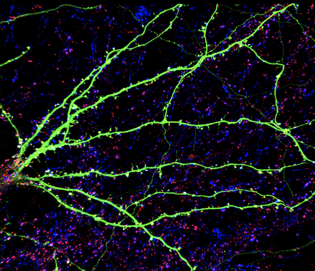 SinaiBrain's tweet photo. AMAZING SCIENCE! Abhishek Sahasrabudhe's image "Synapses in a dish" displays Mouse neurons in a dish showing the pre & post synaptic protein markers!VOTE NOW for #ArtoftheBrain image #12. Most♥️'s wins! #BensonLab #SinaiBAW #BAW2021 #BrainAwarenessWeek https://t.co/KCH0EgpbUS https://t.co/maIeRdnadN