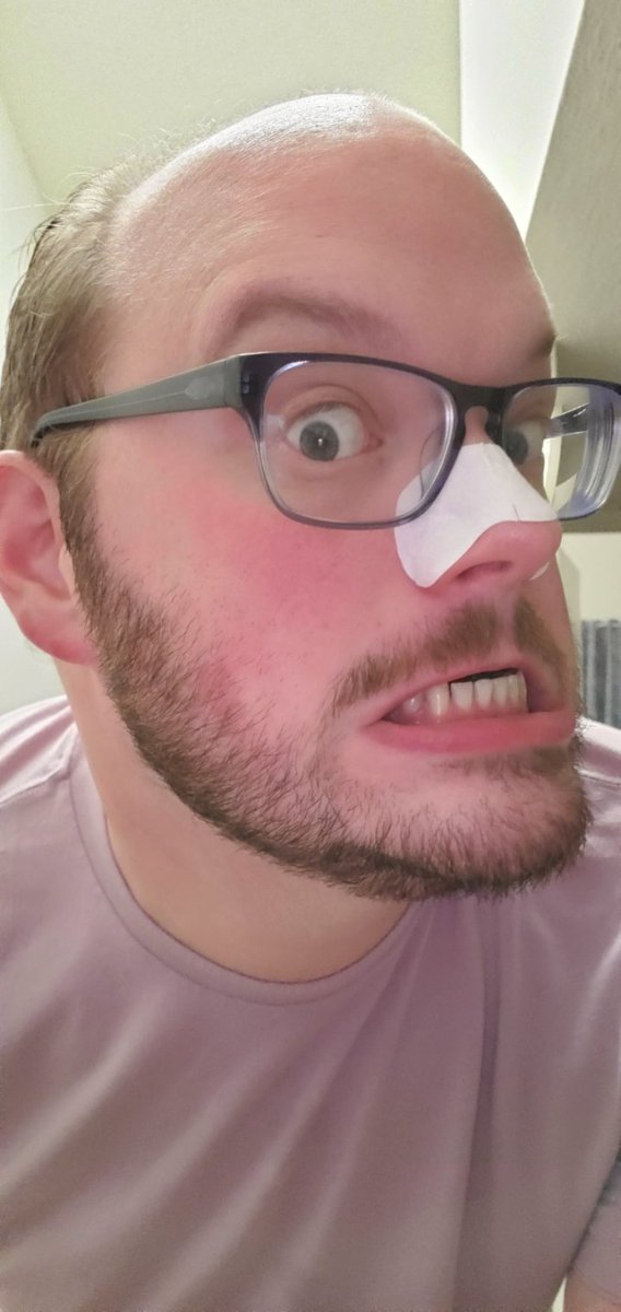 I call this mood "the steady decline to baldness"