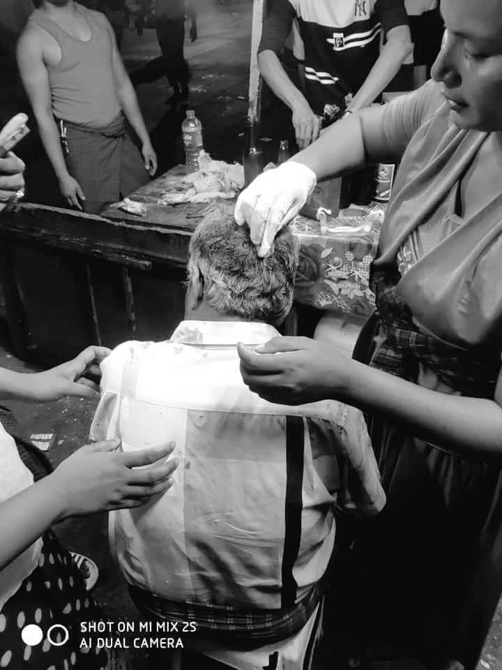 Su76984728's tweet photo. Tw // ⚠️ graphic content // blood

The military terrorists raided and shot in DawPon around 10 p.m last night!!! Thus about 4 old men were injured and took medicament!!!

R2P NOW

#WhatsHappeningInMyanmar
#Mar19Coup https://t.co/G3FCrLPlAs