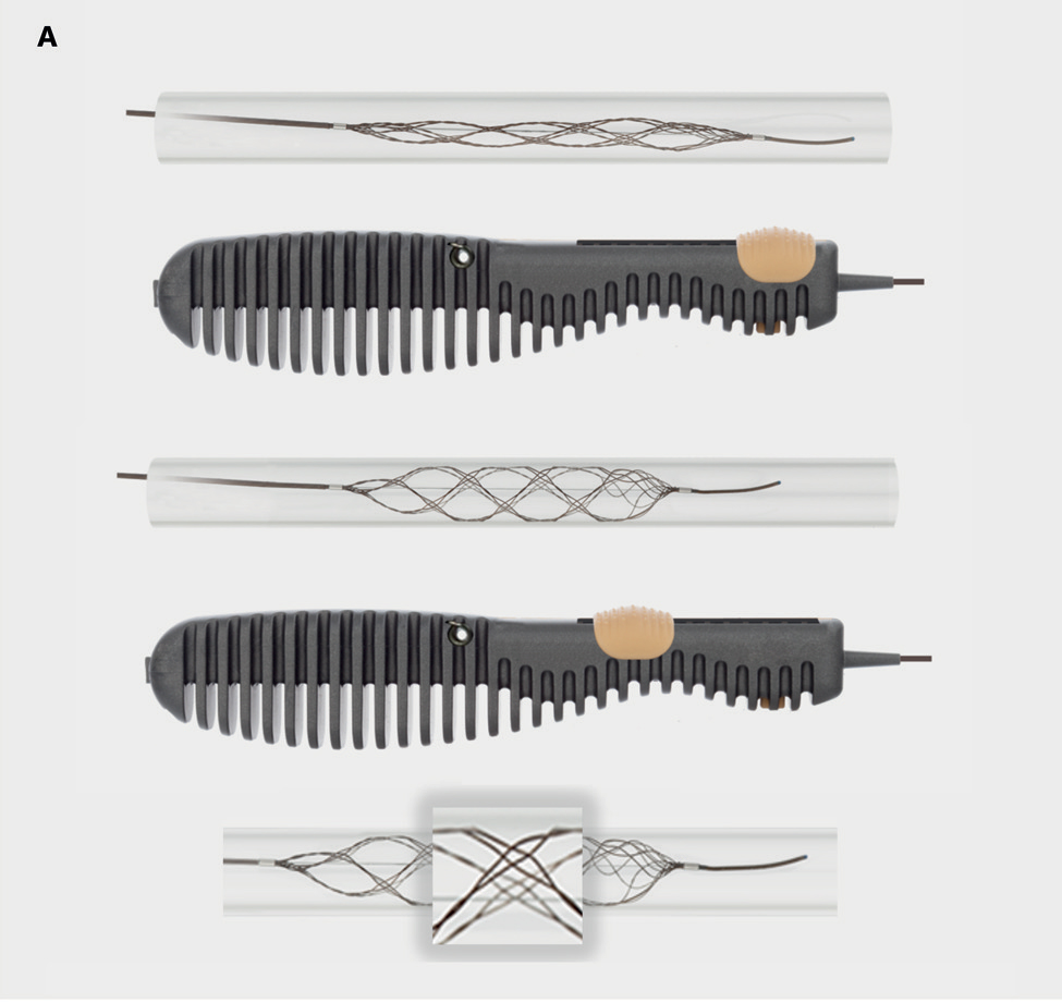 StrokeAHA_ASA's tweet photo. Just Published in #Stroke: "A New Class of Radially Adjustable Stentrievers for Acute Ischemic Stroke: Primary Results of the Multicenter Tiger Trial" #ISC21 @dyavagal @dliebesk @_AdnanSiddiqui @italolinfante @AshuPJadhav @AHAMeetings @AHAScience https://t.co/IbmdvJWw8M https://t.co/uvxRa9tbPV